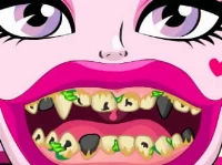 Draculaura bad teeth